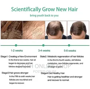 Neo Hair Lotion Treatment Stop Hair Loss Hair Growth Serum