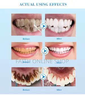 Efero Teeth Whitening Liquid