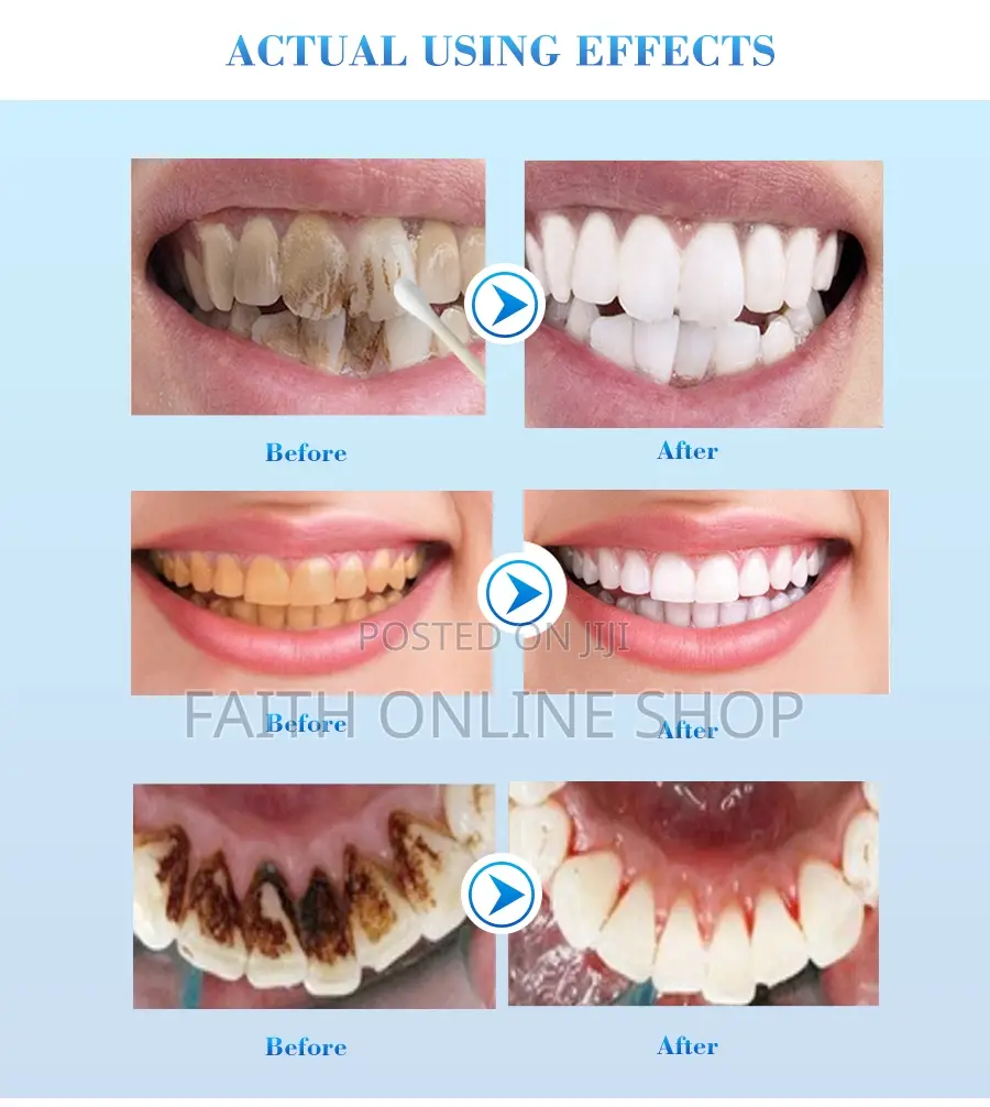 Efero Teeth Whitening Liquid