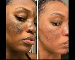 All Facials Butt Lifts