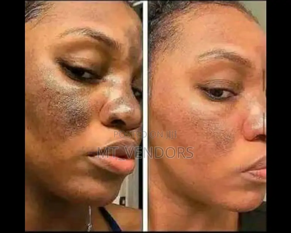 All Facials Butt Lifts