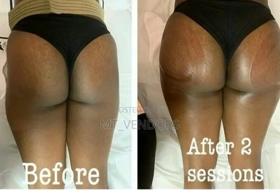 All Facials Butt Lifts