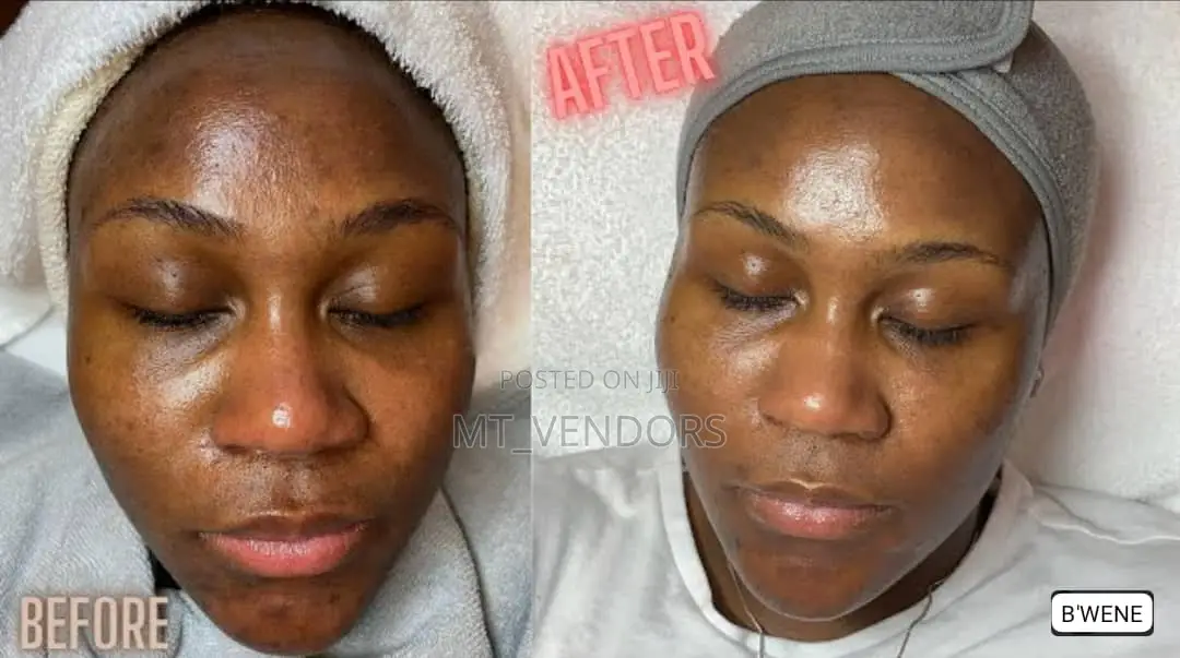All Facials Butt Lifts