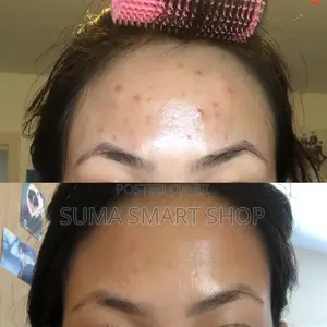 The ORDINARY Glycolic Acid Toning Solution.(Tanzania,Ilala)