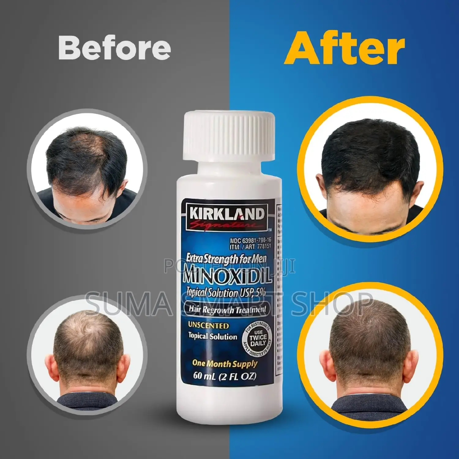 MINOXIDIL Kirkland Hair Regrowth.(Otesha Nywele)