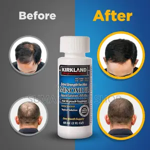 MINOXIDIL Kirkland Hair Regrowth.(Otesha Nywele)