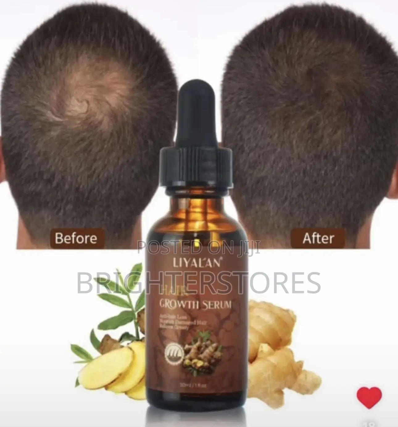Hair Growth