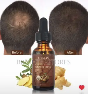 Photo - Hair Growth