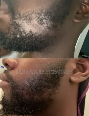 Kirkland Minoxidil 5% Hairgrowth Serum