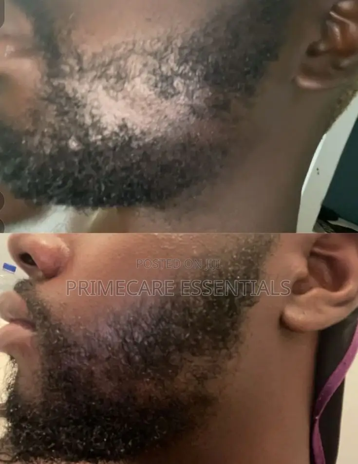Kirkland Minoxidil 5% Hairgrowth Serum