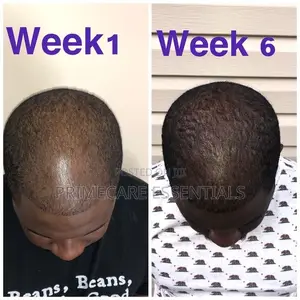 Kirkland Minoxidil 5% Hairgrowth Serum