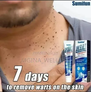 Photo - 7 Warts Removal (Dawa Ya Kuondoa Visunzua Kwenye Ngozi)