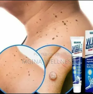 7 Warts Removal (Dawa Ya Kuondoa Visunzua Kwenye Ngozi)