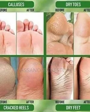 DR. DAVEY Care Foot For Extremely Dry Cracked Feet Balm 100g