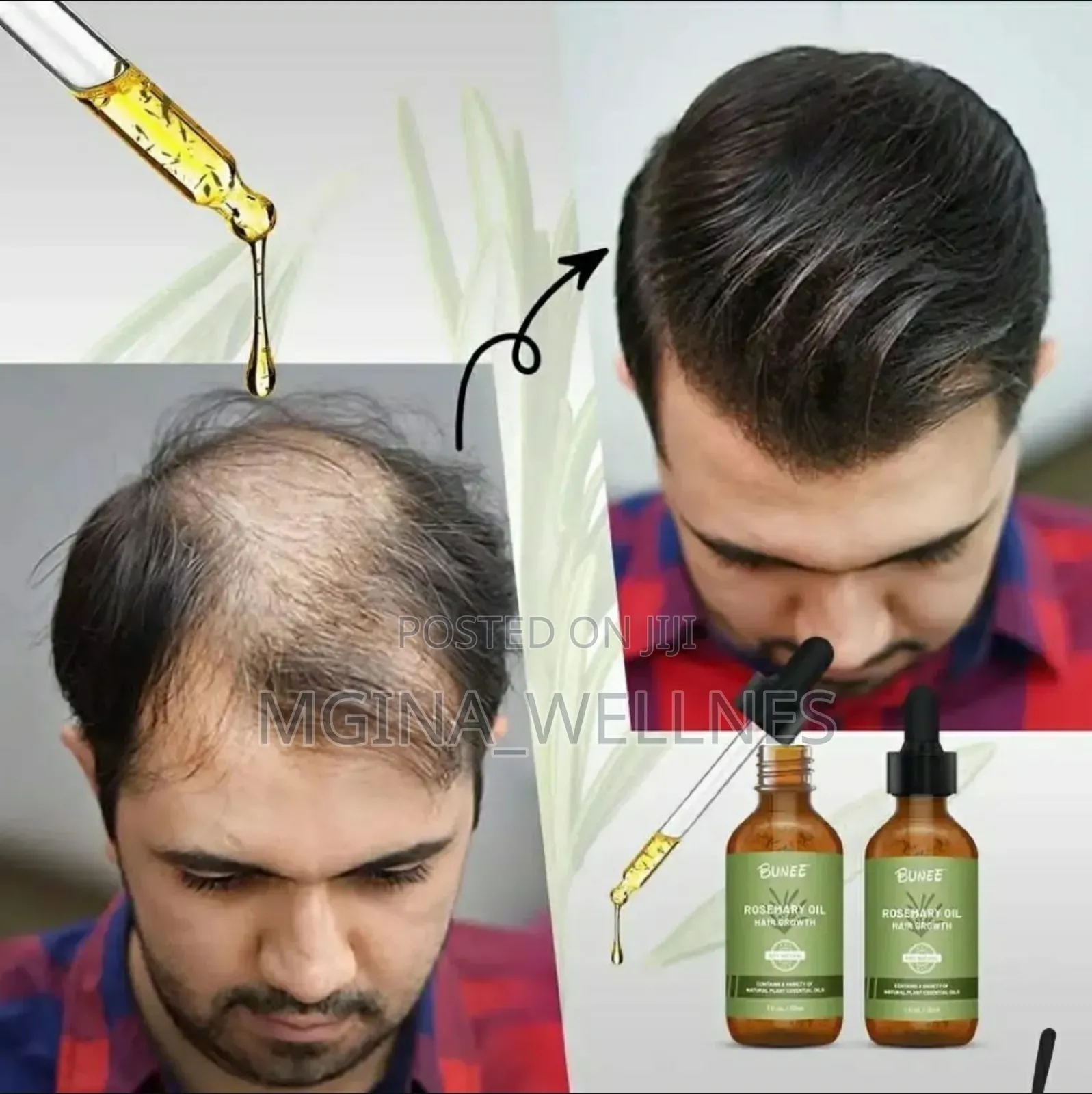 Hair Growth Serum From Thailand (Bunee)