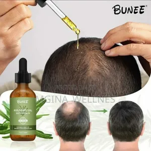 Hair Growth Serum From Thailand (Bunee)