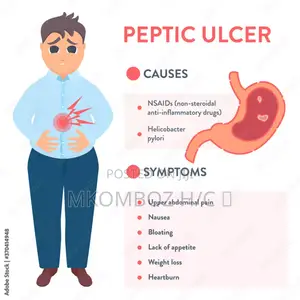 Peptic Ulcers Diseases, Tunatibu Na Kumaliza Pud