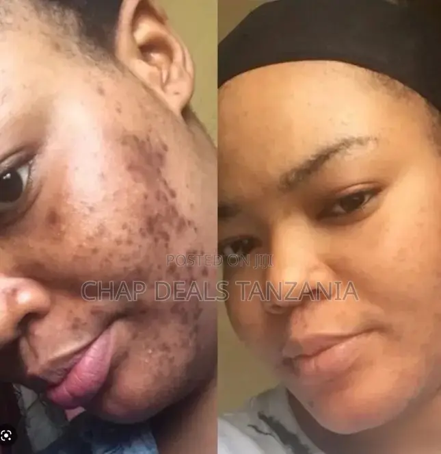 Turmeric Clay Mask