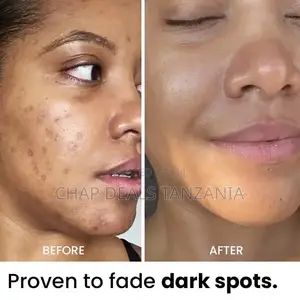 Turmeric Clay Mask