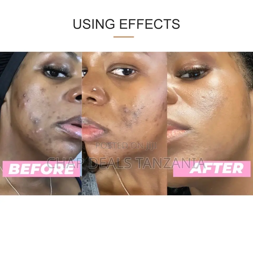 Turmeric Clay Mask