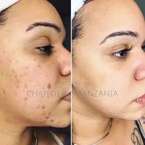 Turmeric Clay Mask