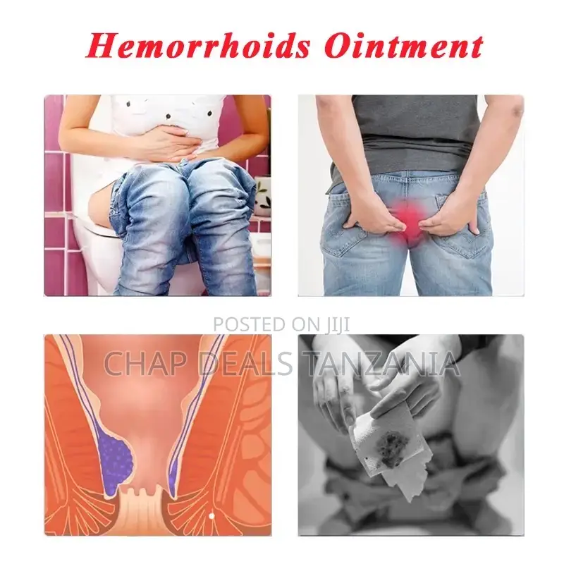 Hemorrhoids/Bawasiri Ointment Cream