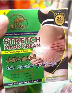 Stretch Mark Cream (Inaondoa Michirizi)