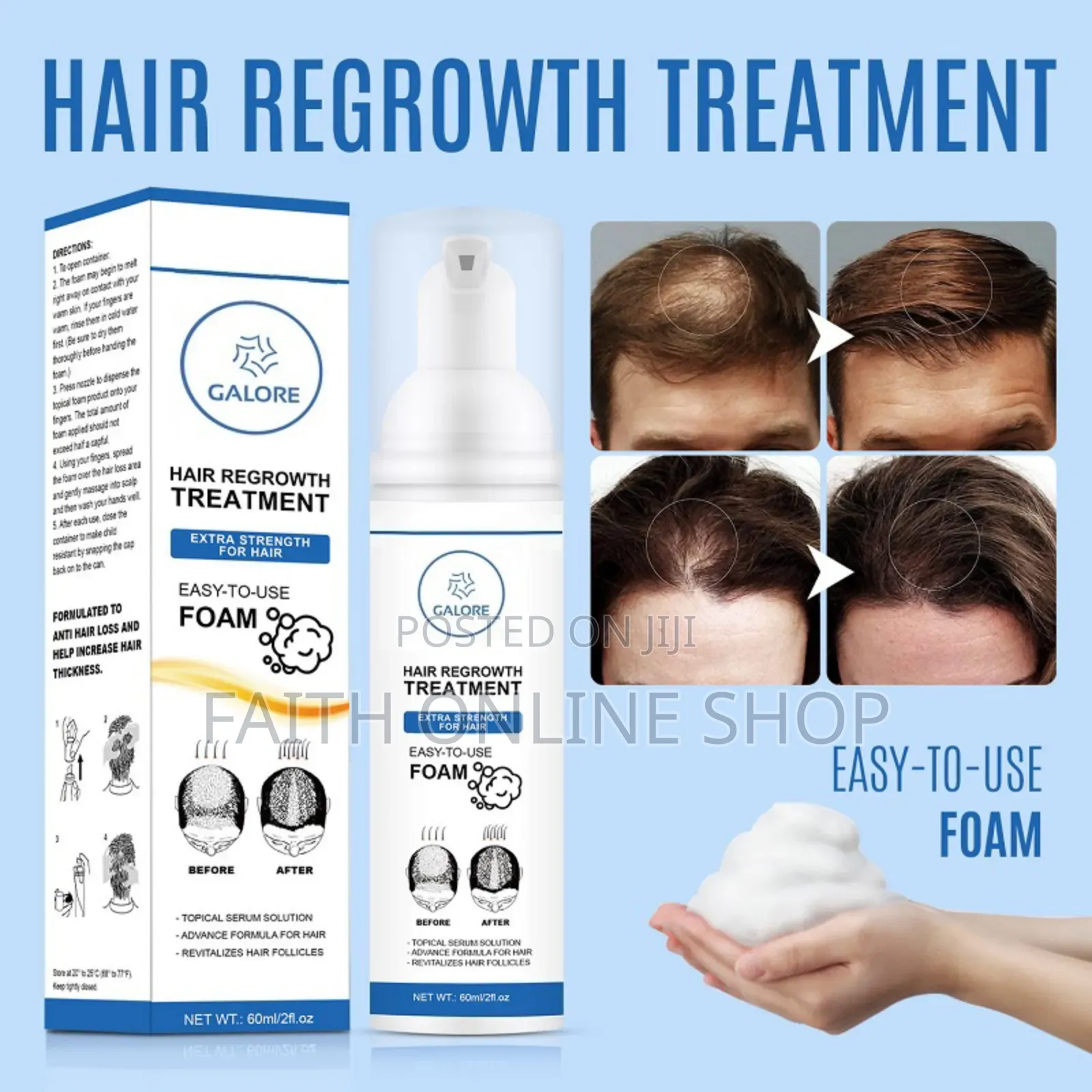FIXXIE Minoxidil Hair Regrowth Foam