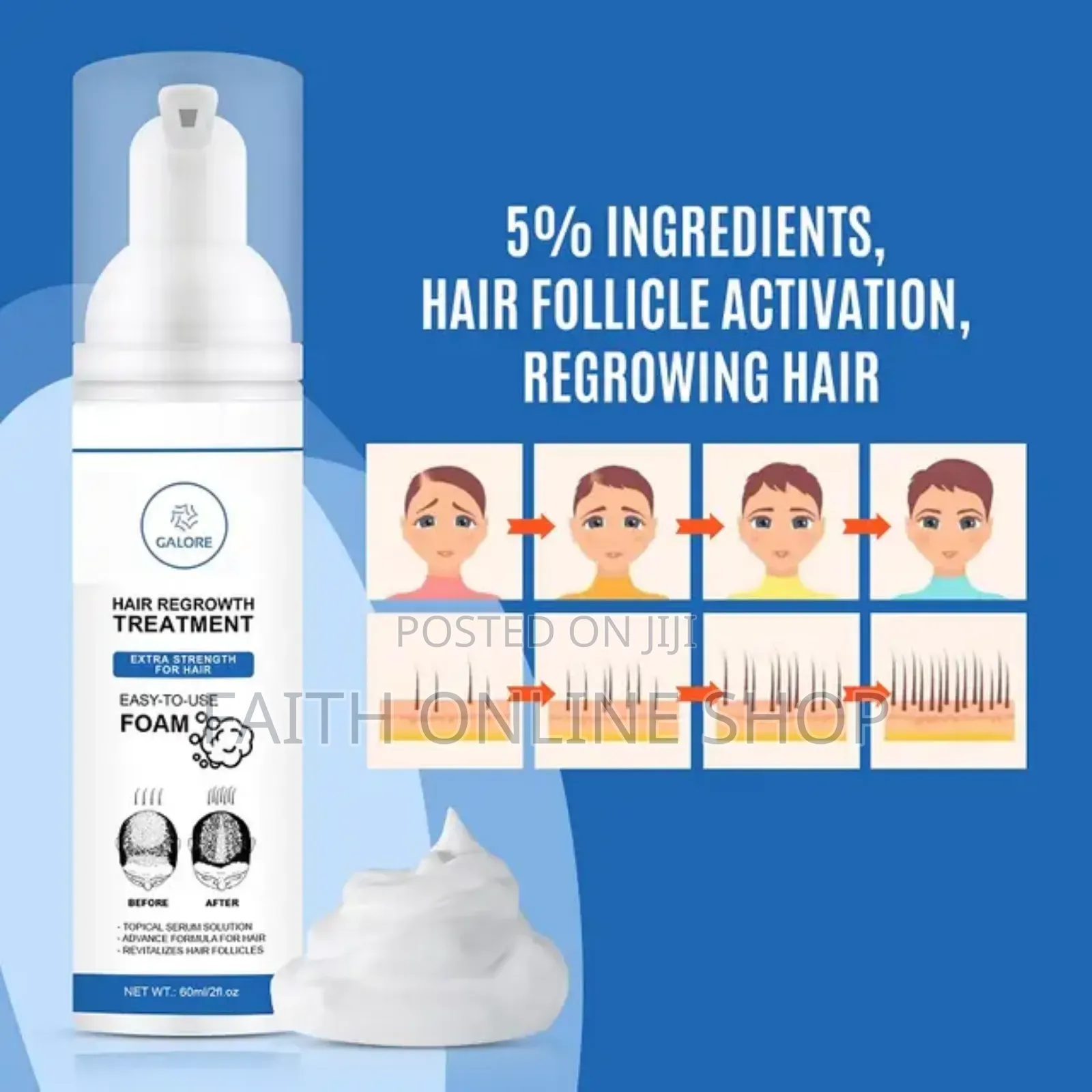 FIXXIE Minoxidil Hair Regrowth Foam