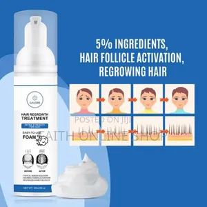 FIXXIE Minoxidil Hair Regrowth Foam