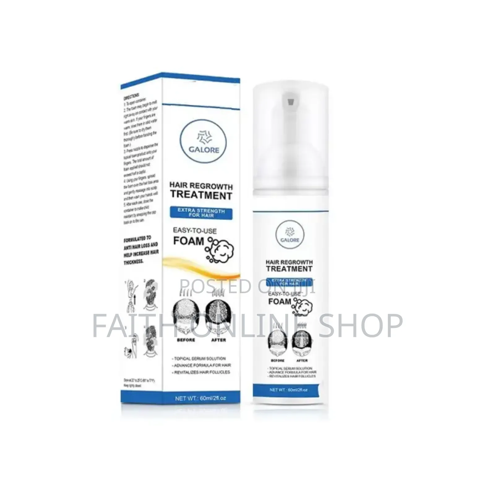 FIXXIE Minoxidil Hair Regrowth Foam