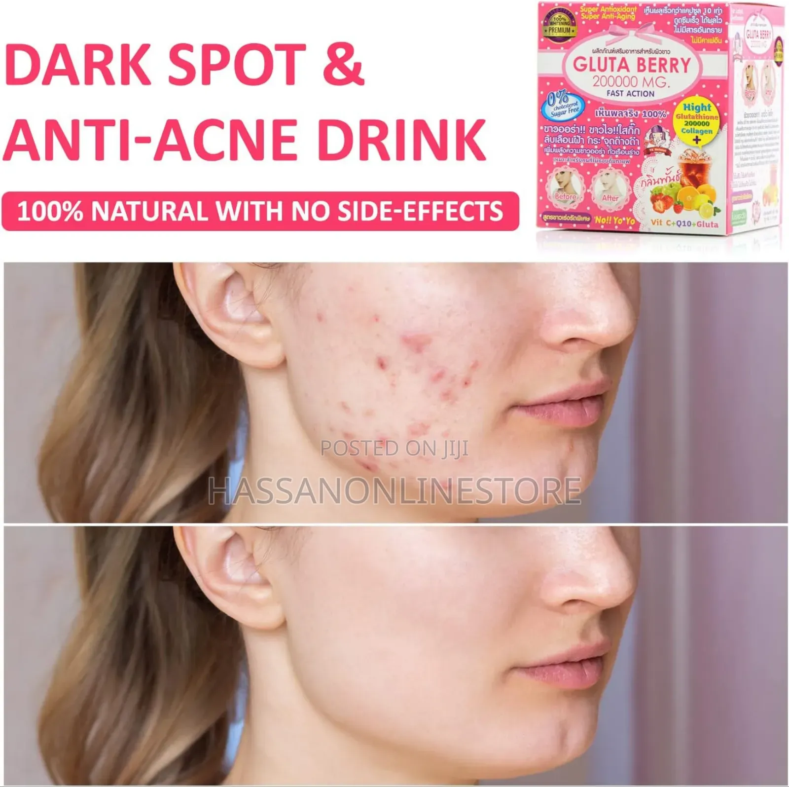 Gluta Berry 200000mg Glutathione Collagen Drink