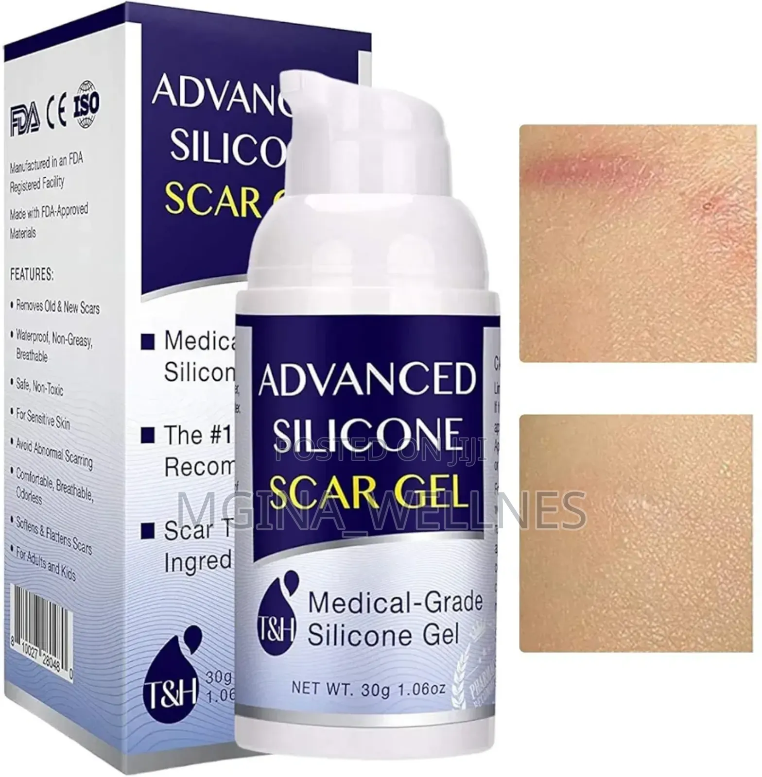 Advanced Scar Remover (Dawa Ya Kuondoa Makovu Na Michirizi