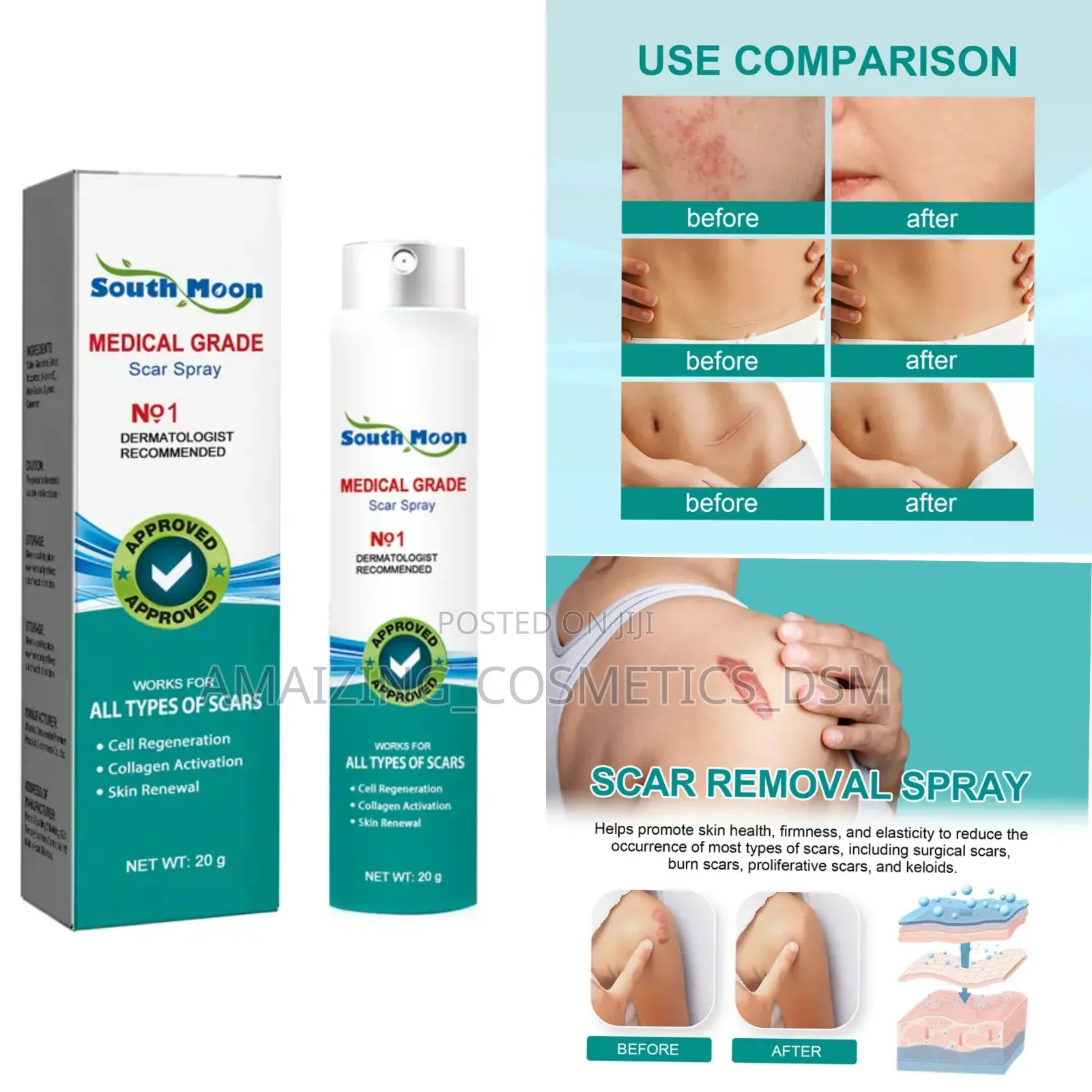 Scar Removal Spray/ Spray Ya Kuondoa Makovu Mwilini