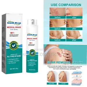 Scar Removal Spray/ Spray Ya Kuondoa Makovu Mwilini