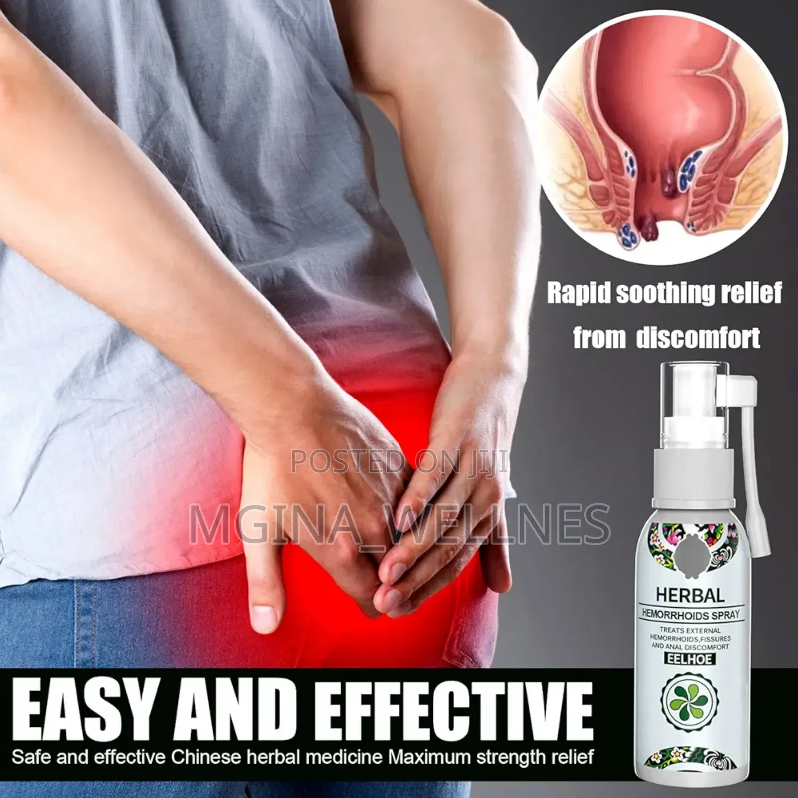 Hemorrhoids Spray (Dawa Ya Kuondoa Bawasiri )