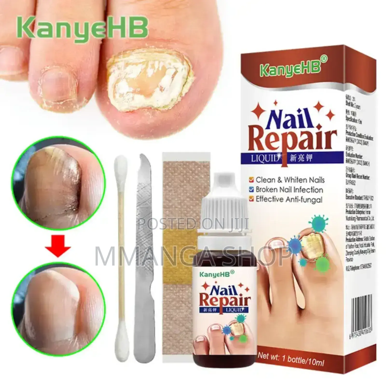 Nail Repair