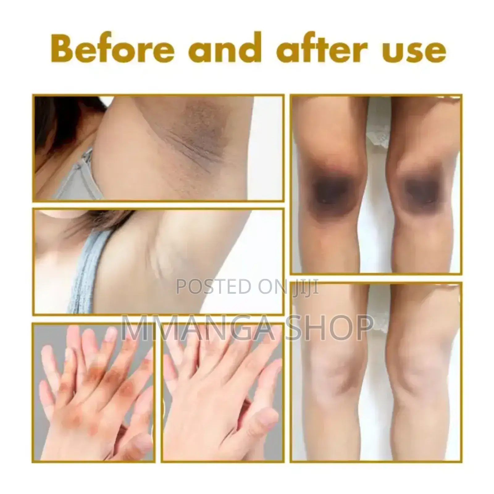 West Month Acanthosis Nigricans Removal Oil