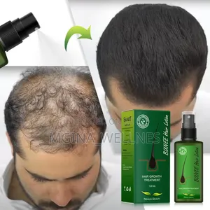 7 Days Neo Hair Lotion for Hair Growth