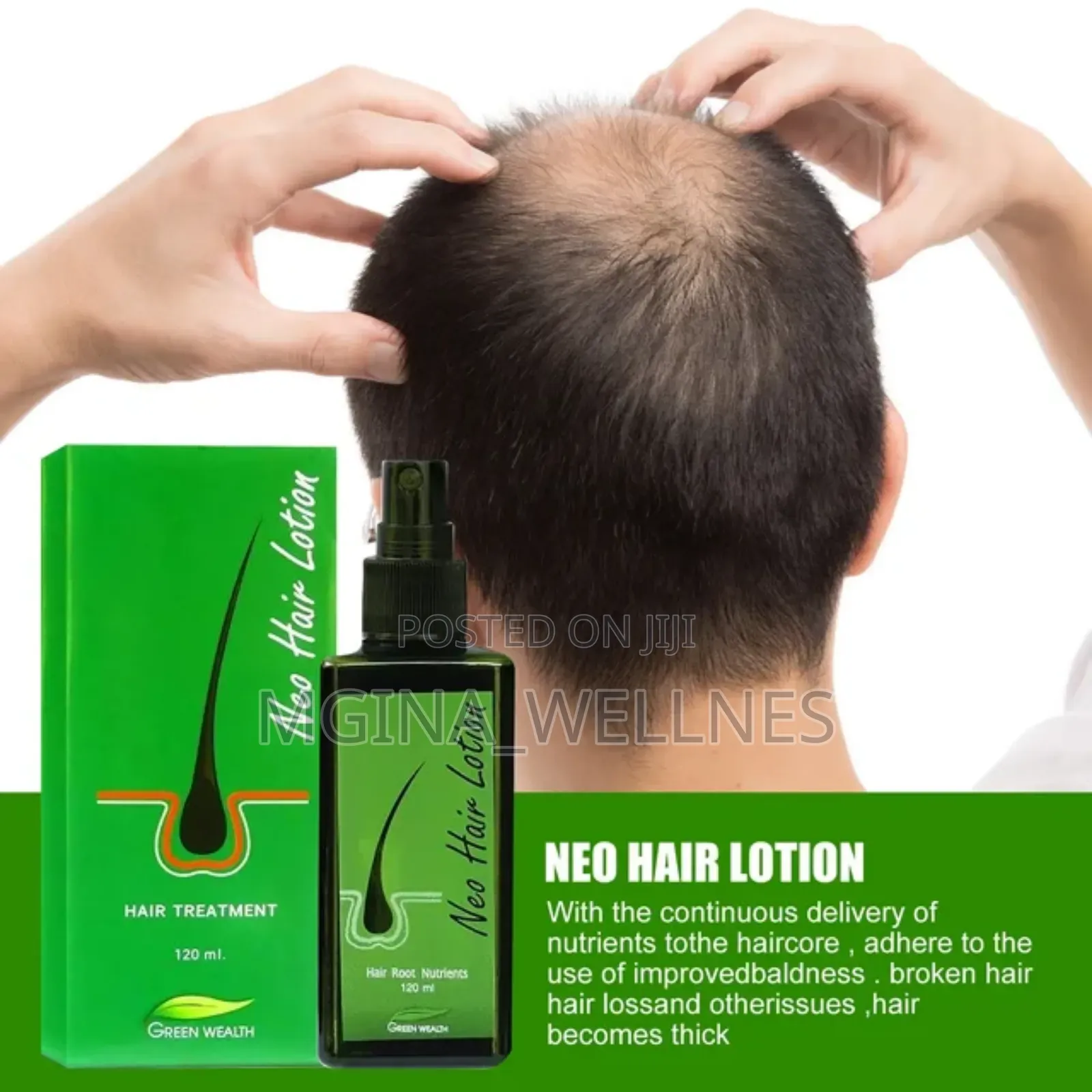 7 Days Neo Hair Lotion for Hair Growth
