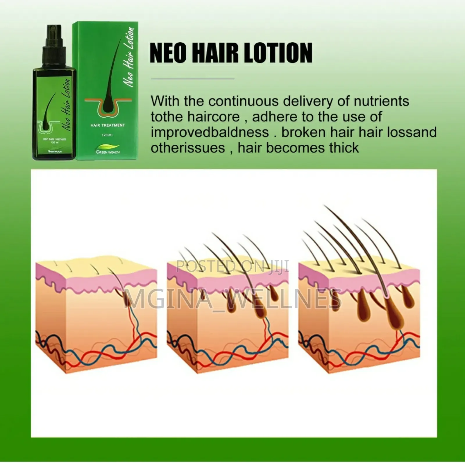 7 Days Neo Hair Lotion for Hair Growth