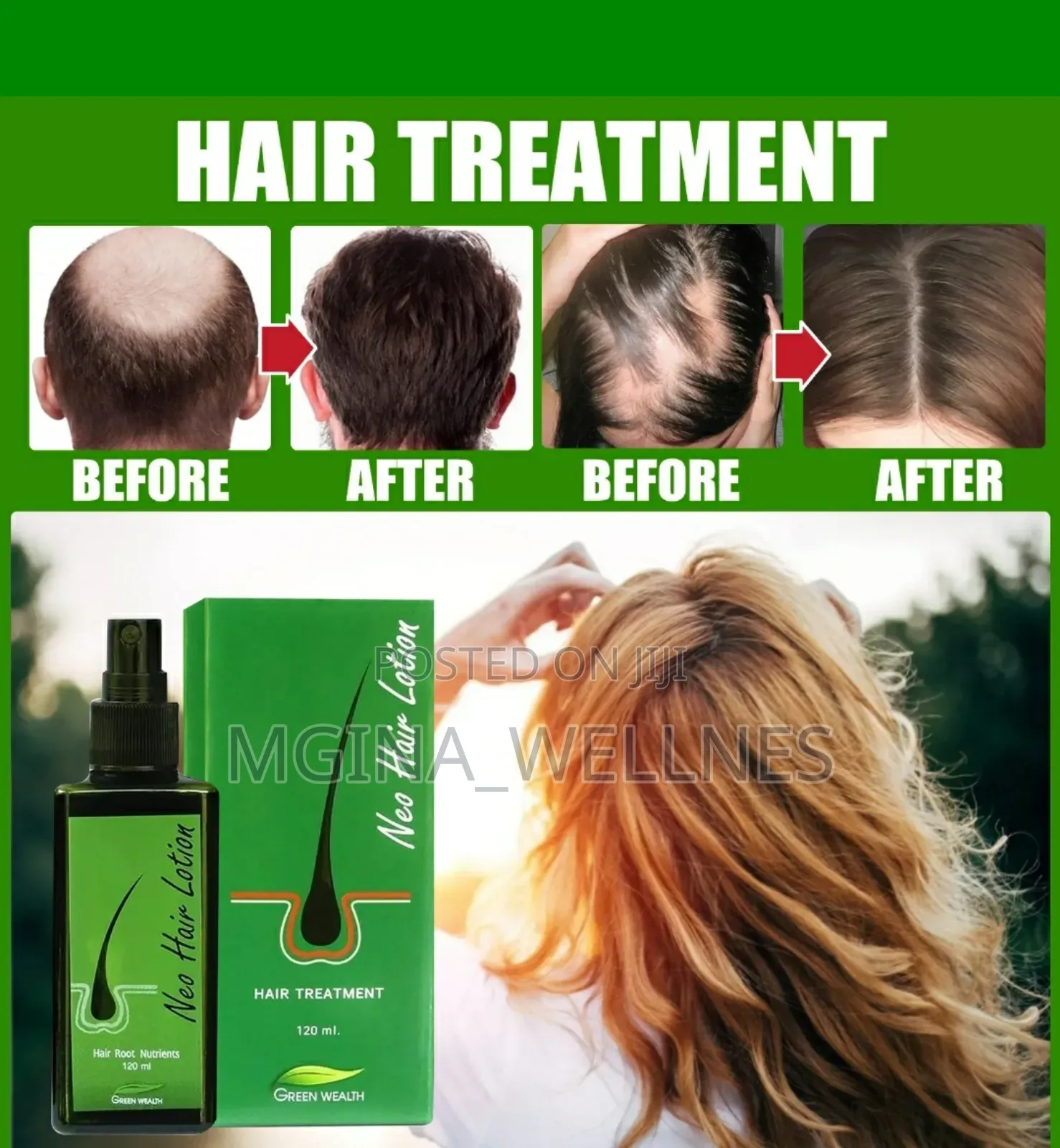 7 Days Neo Hair Lotion for Hair Growth