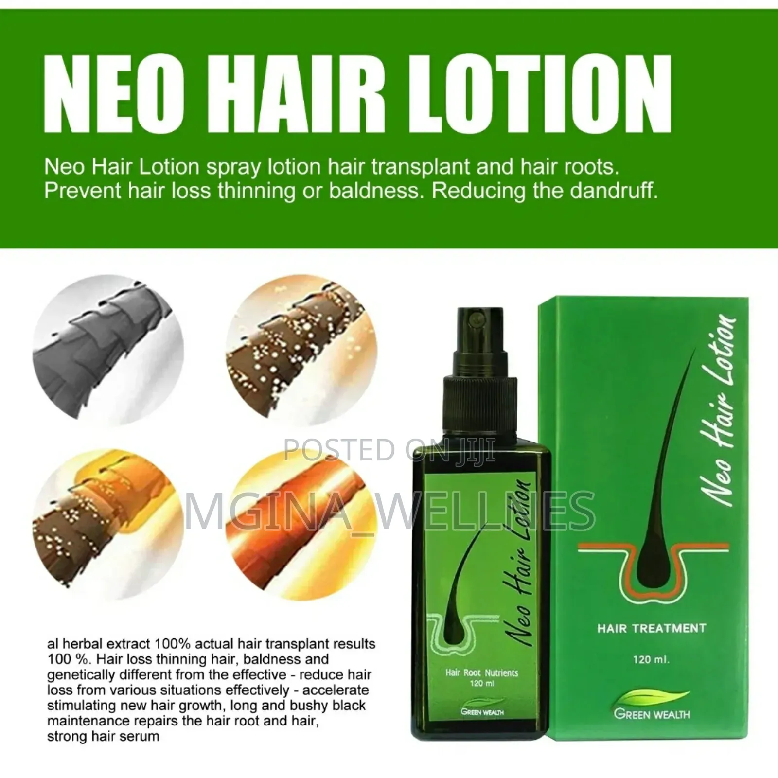 7 Days Neo Hair Lotion for Hair Growth