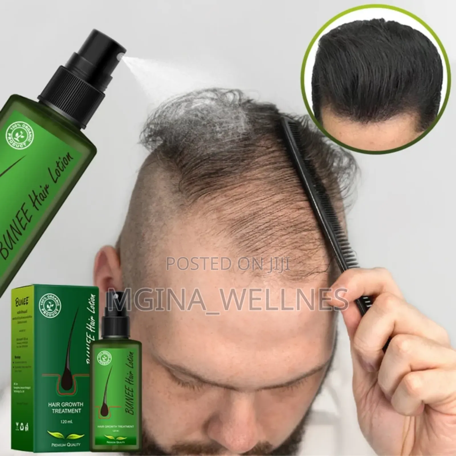 7 Days Neo Hair Lotion for Hair Growth