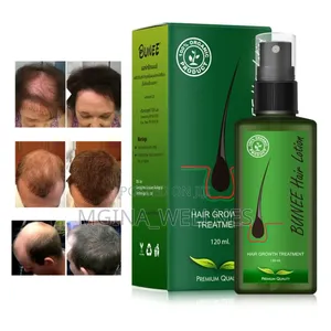 Photo - 7 Days Neo Hair Lotion for Hair Growth