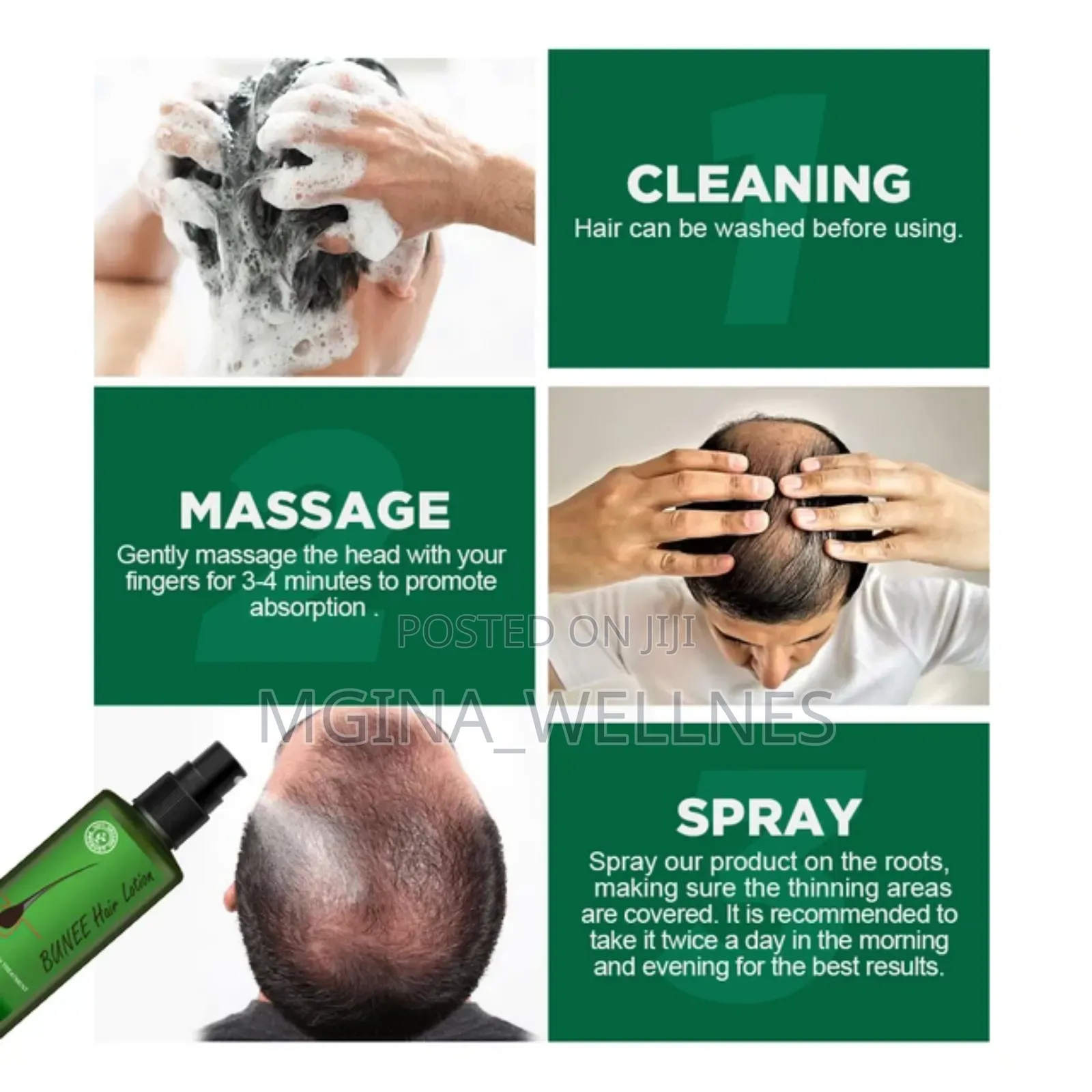 7 Days Neo Hair Lotion for Hair Growth