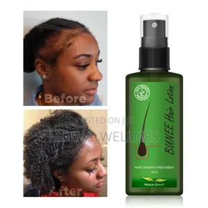 7 Days Neo Hair Lotion for Hair Growth
