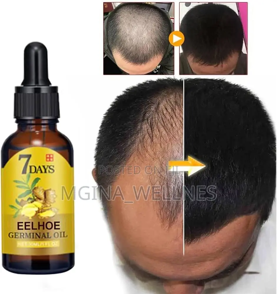 Hair Growth Serum, Germinal Oil, Very Fast Hair Growth