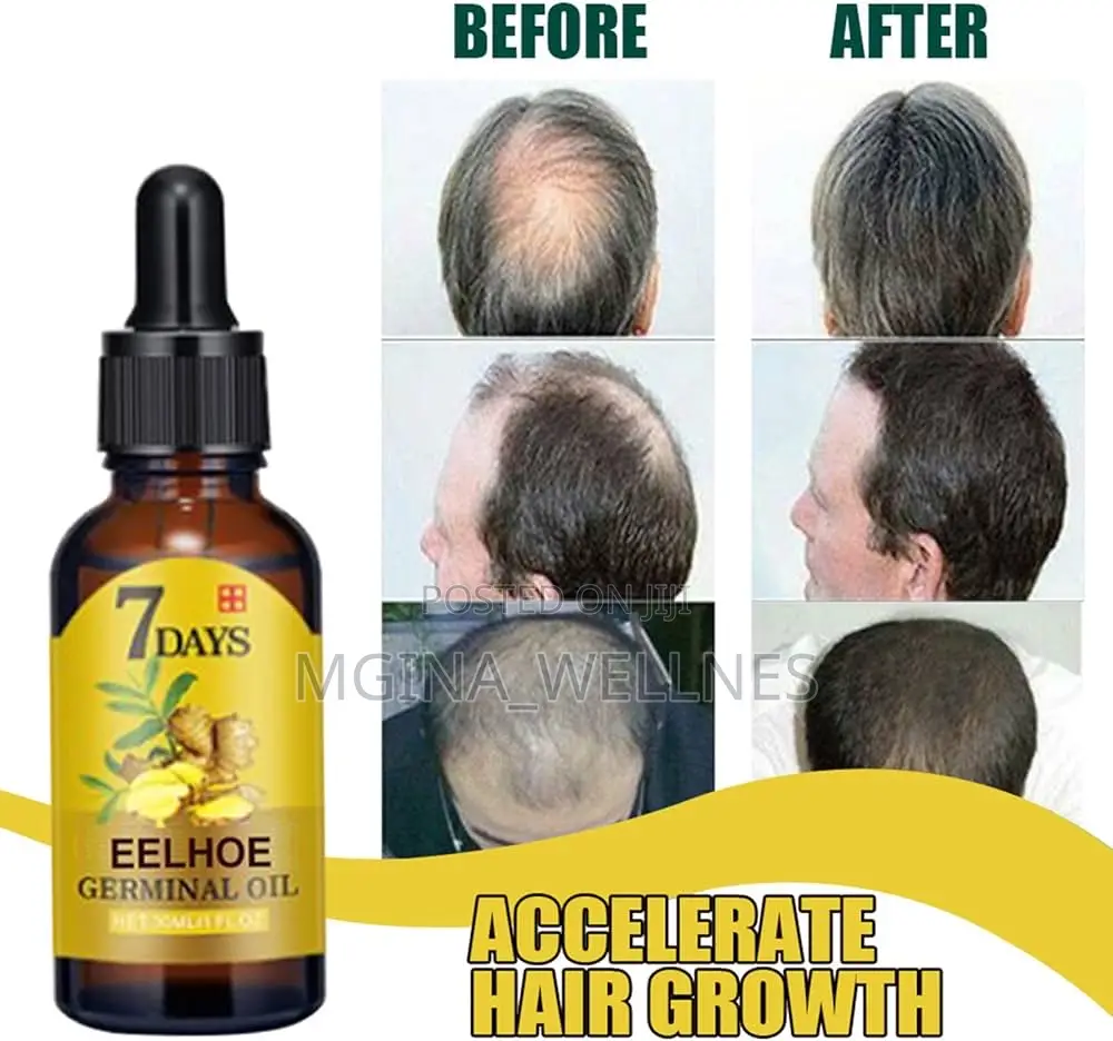 Hair Growth Serum, Germinal Oil, Very Fast Hair Growth