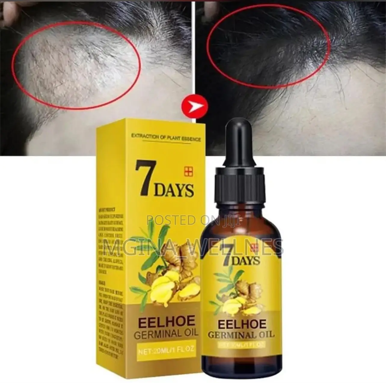 Hair Growth Serum, Germinal Oil, Very Fast Hair Growth